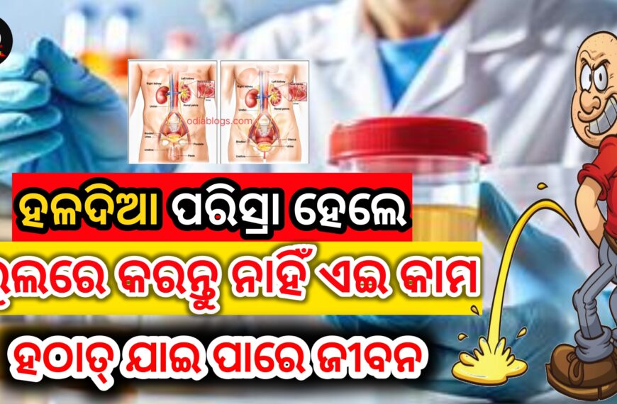 Yellow Urine Problem in Summer: Health…